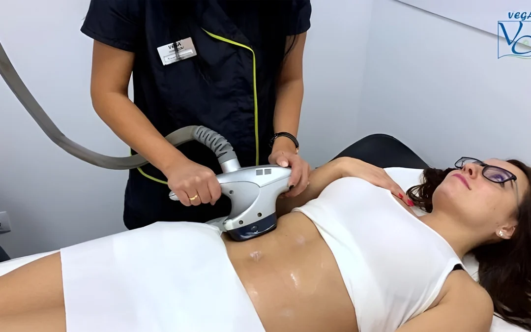 Защо е препоръчителна антицелулитната процедура VelaShape?