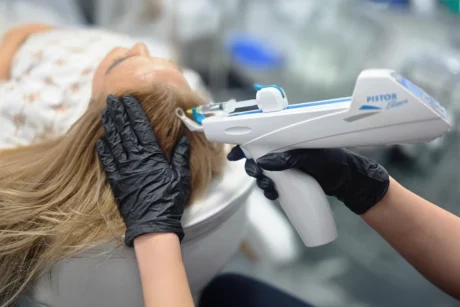 Мезотерапия за коса